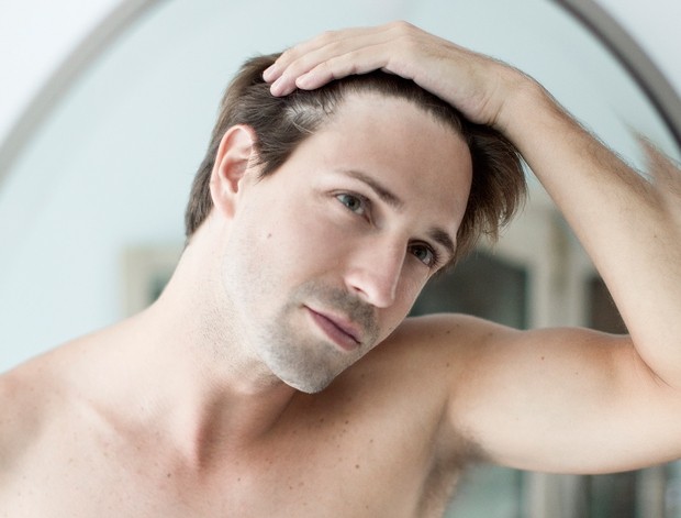 10 THINGS YOU SHOULD KNOW ABOUT MALE HAIR LOSS