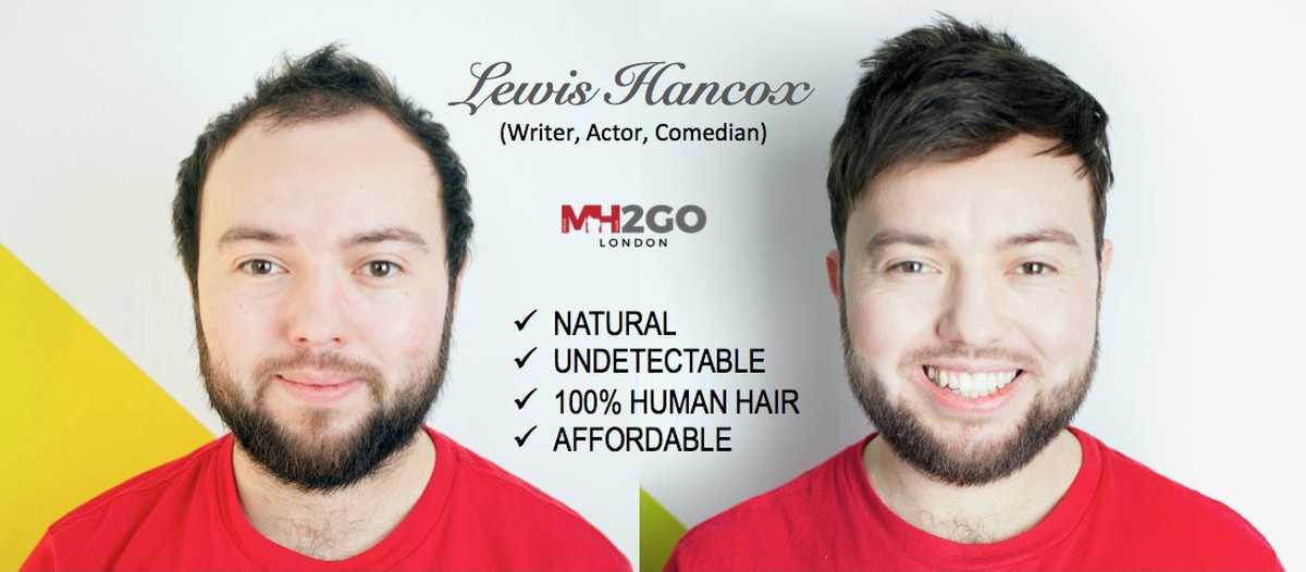 Mens Hair 2 Go Hair Systems Uk Mens Hair Replacement Hair