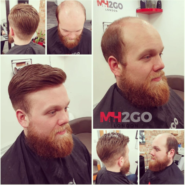 Mens Hair 2 Go Hair Systems Uk Mens Hair Replacement Hair Systems London
