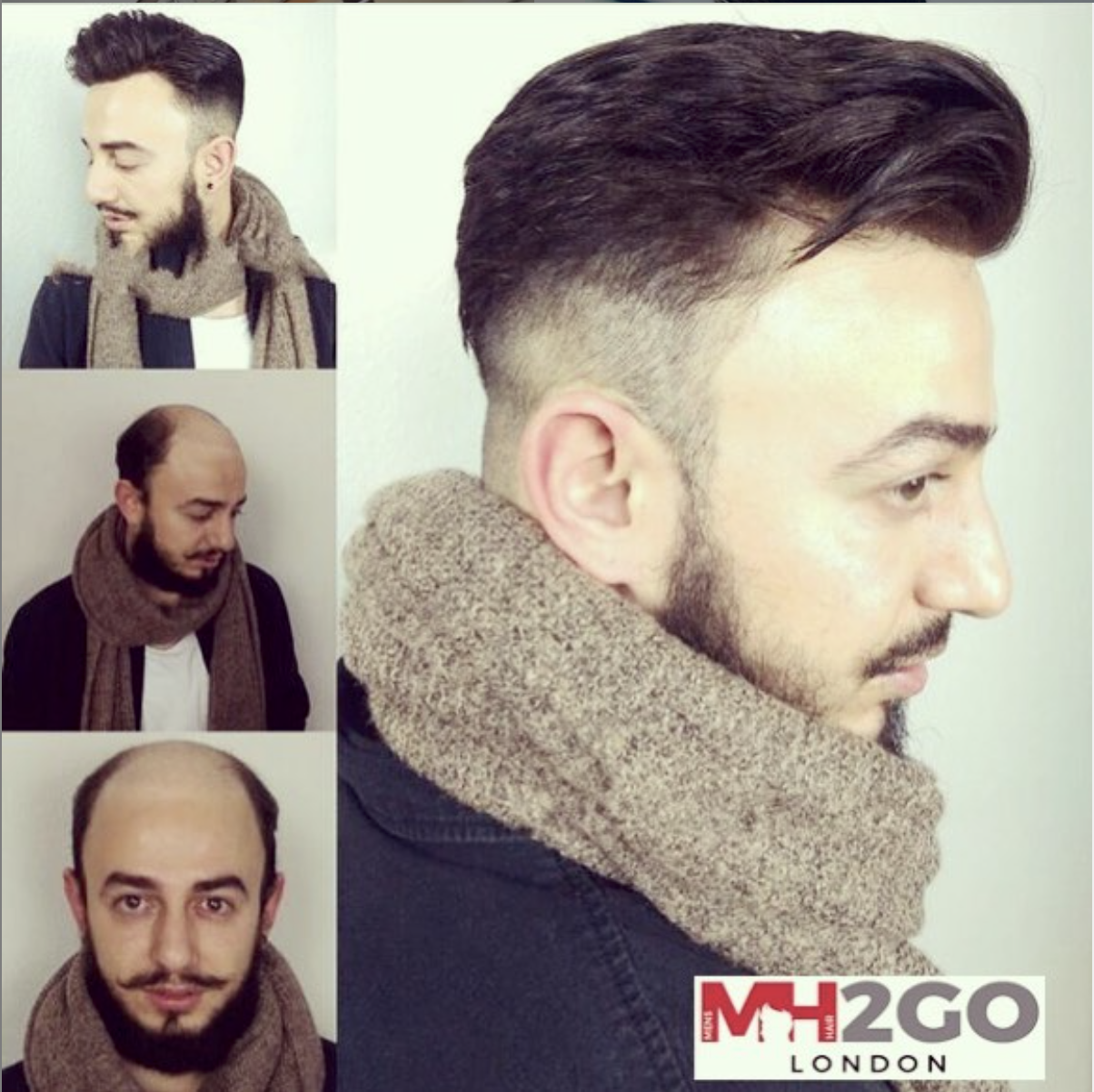 Mens Hair 2 Go-Hair Systems Uk, Mens Hair Replacement, Hair Systems London